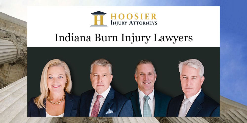 indiana burn injury lawyers